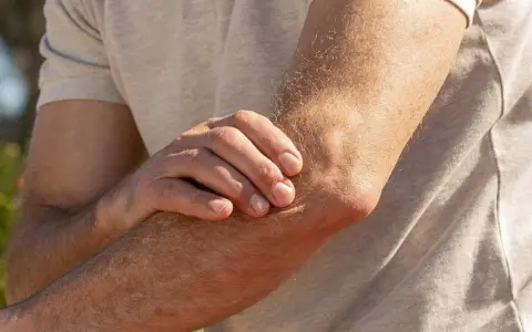 Mann hält seinen Arm, da er Ellenbogen Schmerzen beim Strecken hat.