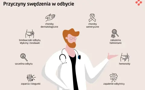 Lekarz omawia przyczyny swędzenia odbytu, w tym hemoroidy, zaparcia i biegunki, które mogą wymagać leczenia domowego.