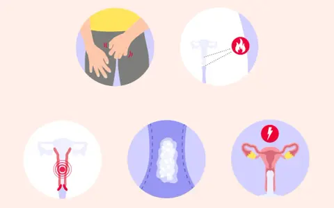 Illustrationen zeigen Juckreiz im Intimbereich, Entzündungssymptome, Ausfluss und Schmerzen. So sieht scheidenpilz aus.