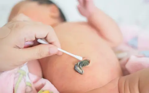 Jak czyścić kikut pępowinowy? Prosty poradnik dla rodziców