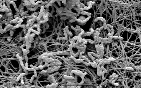 Achromobacter xylosoxidans, batteri filamentosi che colonizzano una matrice extracellulare fibrosa.