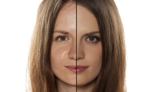 Viso diviso: a sinistra pelle con sebo e imperfezioni, a destra pelle uniformata dal trucco.