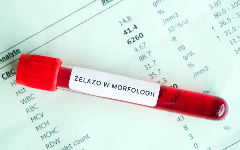 Probówka z krwią na tle wyników morfologii. Etykieta "ŻELAZO W MORFOLOGII" sugeruje badanie pod kątem przyczyn niedoboru żelaza.