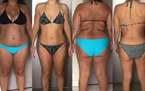 Avant/après : une femme en bikini montre sa silhouette, avec une perte de hanches visible.