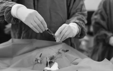 Mani guantate preparano una siringa per la picc chemio, un momento delicato di cura.