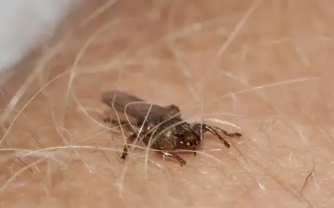 Owady przypominające kleszcze, ale z widocznymi skrzydłami, mogą sugerować, czy kleszcze latają. Ten owad jest na ludzkiej skórze.