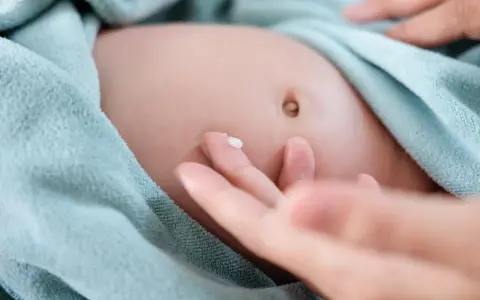 Delikatna pielęgnacja brzuszka niemowlaka. Kropelka kremu na palcu, gotowa do naniesienia na pępek, gdzie może występować przepuklina pępkowa.