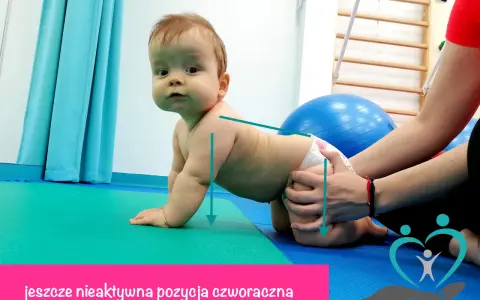 Niemowlę w pozycji czworaczej, z rękami na macie. Terapeuta delikatnie podtrzymuje dziecko, pomagając mu w nauce ruchu. To jeszcze nie jest raczkowanie do tyłu, ale pierwszy krok do samodzielności.