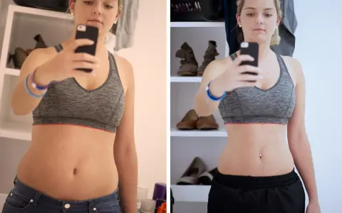Kobieta w sportowym topie robi sobie selfie, pokazując brzuch przed i po zabiegu.