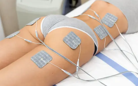 Elektrostymulacja efekty po 10 zabiegach: widoczne napięcie mięśni ud i pośladków dzięki elektrostymulacji.