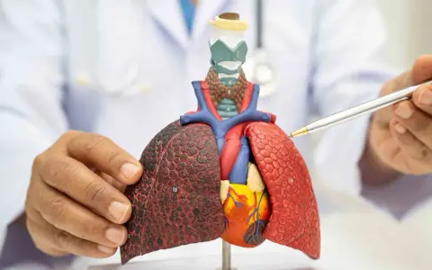 Un médico señala un modelo de pulmones y corazón, mostrando los efectos del vapeo en los pulmones de vapeador.