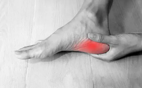 Pie con dolor en el talón, simulando fascitis plantar en niños.