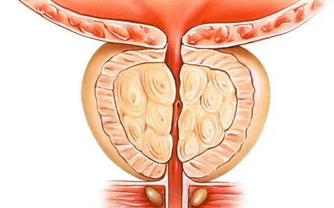 Masaż prostaty jak wykonać: bezpieczne techniki i ważne wskazówki