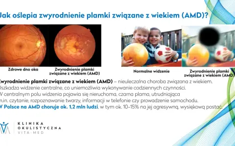 Badanie dna oka co wykrywa: zdrowe oko vs. zwyrodnienie plamki związane z wiekiem (AMD), wpływające na widzenie.
