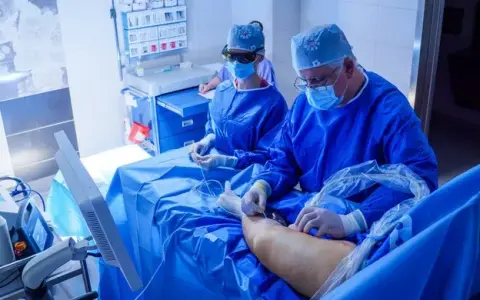 Żylaki: Jakiego lekarza wybrać? Flebolog, angiolog, chirurg