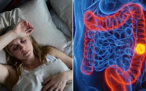 Frau im Bett, besorgt. Daneben eine 3D-Darstellung des Darms mit einem leuchtend gelben Tumor. So fing Darmkrebs an.