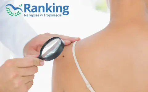 Dermatolog ogląda pieprzyk pod lupą na ramieniu pacjentki.