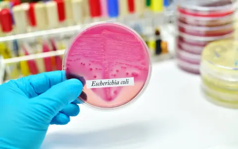 Różowa pożywka z koloniami bakterii Escherichia coli. Badanie laboratoryjne pomaga wykryć bakteria coli objawy.