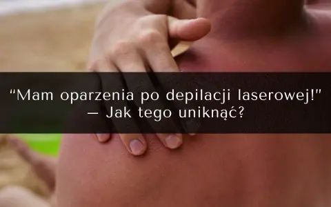 Oparzenia po depilacji laserowej to częsty problem. Zobacz, jak uniknąć powikłań i jakie są opinie o zabiegu.