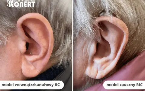 Porównanie dyskretnego aparatu wewnątrzusznego IIC i widocznego aparatu słuchowego zausznego RIC.