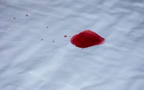 Une tache de sang rouge vif sur un tissu blanc. L'eau oxygénée pourrait aider à nettoyer cette tache.