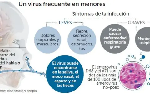 Infografía sobre enterovirus en niños, detallando síntomas leves y graves, dónde se encuentra el virus y tipos específicos como D68 y A71.