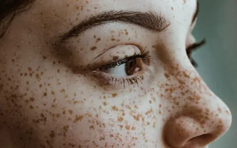 Jaka henna do piegów? Zrób naturalne piegi bezpiecznie!