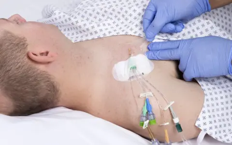 Ein Arzt mit blauen Handschuhen sichert einen zentralen Venenkatheter (pvk medizin) bei einem liegenden Patienten.