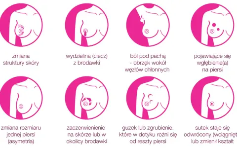 Grafika pokazuje objawy raka piersi: guzek, zmiany skórne, wydzielinę z brodawki, ból, wgłębienia, asymetrię, zaczerwienienie i odwrócony sutek.