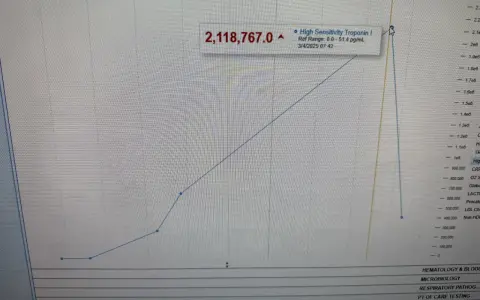 Podwyższona troponina: Co oznacza? Zawał czy inna przyczyna?