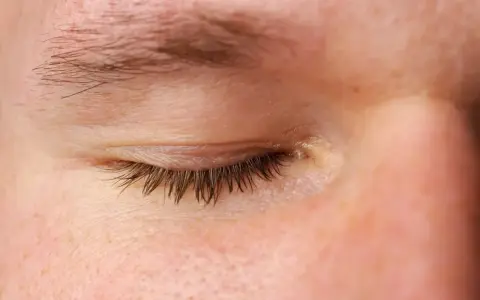 Ojo cerrado con pestañas oscuras y piel con leve grasa en los párpados.