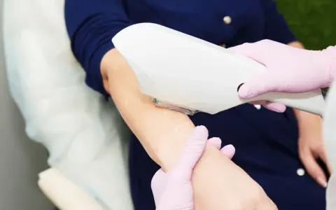 Profesional depilándose los brazos con láser. Una decisión personal sobre depilarse los brazos si o no.