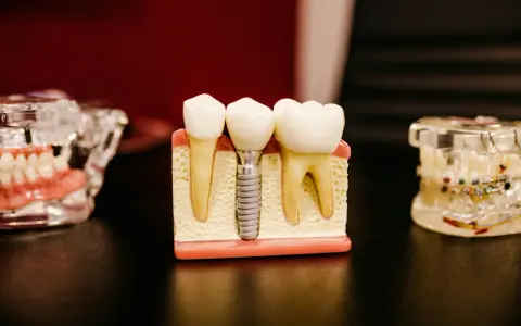 Stomatolog Lublin – kiedy warto zmienić dentystę i na co realnie zwrócić uwagę przy wyborze gabinetu