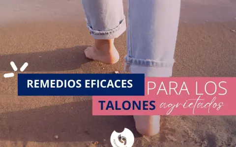 Remedios eficaces para talones agrietados. Pies descalzos caminan sobre la arena, buscando alivio para las heridas en el talón del pie.