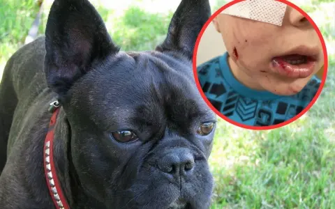 Czarny buldog francuski obok dziecka z ranami na twarzy i ustach, opatrzonymi plastrem.