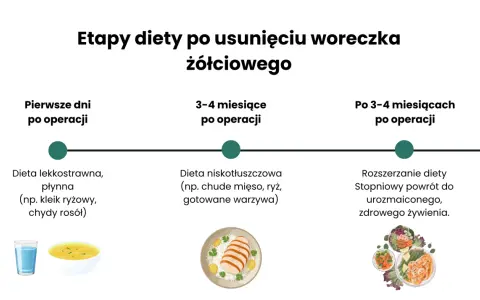 Etapy diety po operacji woreczka żółciowego: płynna dieta lekkostrawna, potem niskotłuszczowa, aż do powrotu do zdrowego żywienia.