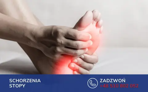 Dłoń uciska bolesną stopę, sugerując problem ze stopą Mortona.