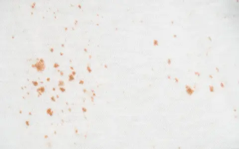 Manchas de óxido en ropa de color blanco. Aprende a quitar manchas de óxido en ropa de color fácilmente.