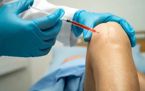 Lekarz w niebieskich rękawiczkach wykonuje zastrzyk w kolano pacjenta. Widać bliznę po wcześniejszej operacji.