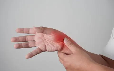 Main douloureuse, avec une zone rouge vif indiquant une possible fracture de fatigue main.
