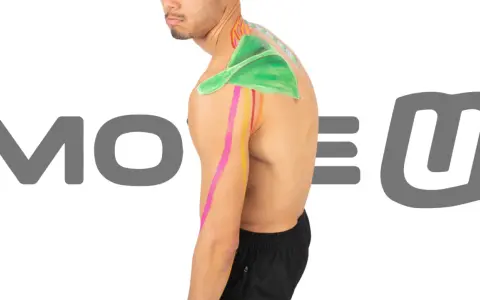 Kinesiotaping wdowi garb: kolorowe taśmy na ramieniu i plecach mężczyzny, wspierające postawę.