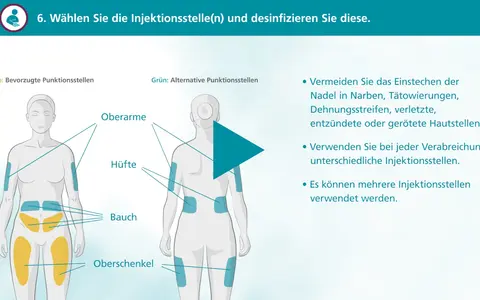 Illustration zeigt bevorzugte (gelb) und alternative (grün) Injektionsstellen am Körper, z.B. Oberschenkel.
