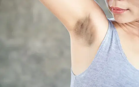 Primer plano de una axila con manchas oscuras y vello visible.