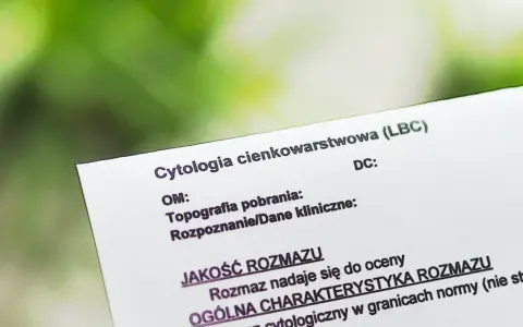 Wynik cytologii cienkowarstwowej (LBC). Dokument porównuje cytologię płynną a zwykłą, oceniając jakość rozmazu.