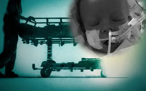 Echo serca czy EKG? Odkryj, co naprawdę widzi Twoje serce