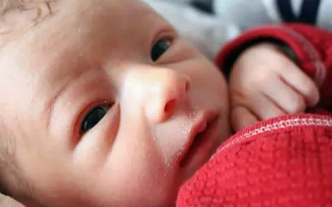 Primo piano del viso di un neonato con crosta lattea. La sua manina è appoggiata su una coperta rossa.