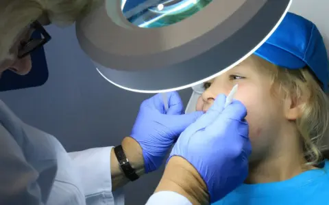 Dentysta w rękawiczkach bada usta dziecka pod lampą powiększającą.