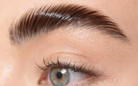 Sourcil trop plaqué, aspect gras, un brow lift raté qui ne met pas en valeur l'œil.