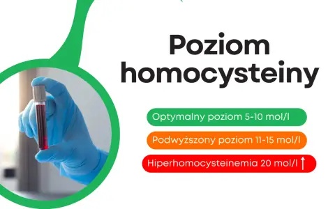 Poziom homocysteiny: optymalny 5-10, podwyższony 11-15, hiperhomocysteinemia >20. Ręka w rękawiczce trzyma probówkę z krwią.