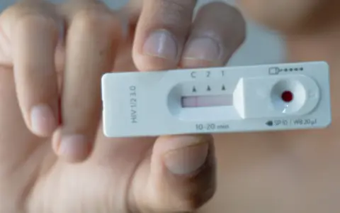 Dłoń trzyma test na HIV z widocznym wynikiem.